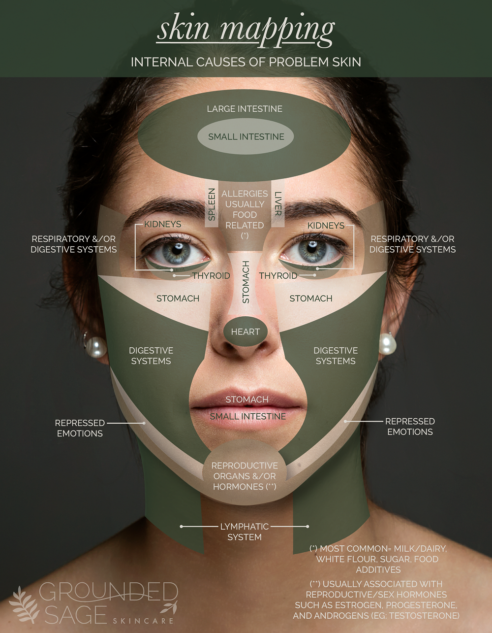 Acne Face Map / skin mapping / acne explained / internal causes of acne / holistic beauty / green beauty