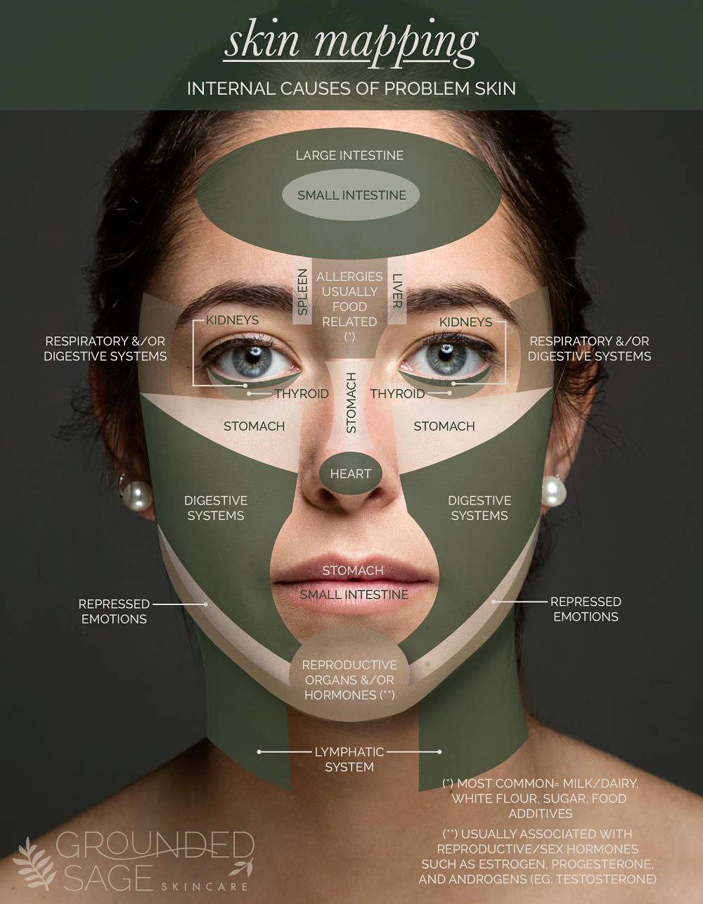 acne diagram of the face