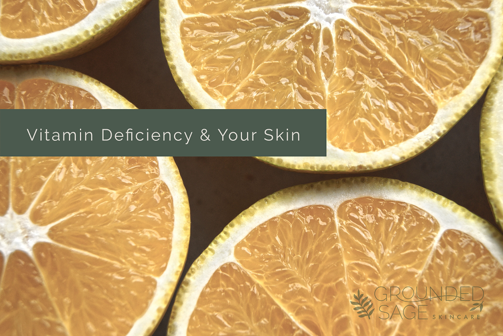 vitamin deficiency & your skin / skincare / holistic skincare / green beauty / vitamins for skin / skincare supplements