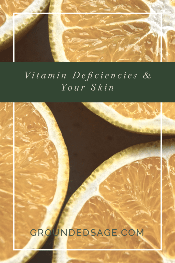 vitamin deficiency & your skin / skincare / holistic skincare / green beauty / vitamins for skin / skincare supplements