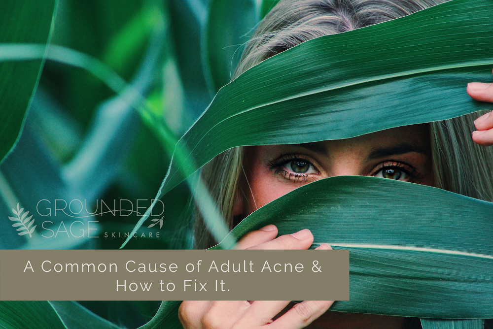 Common cause of adult acne and how to fix it / acne-prone skin / hormonal acne / green beauty / holistic beauty 