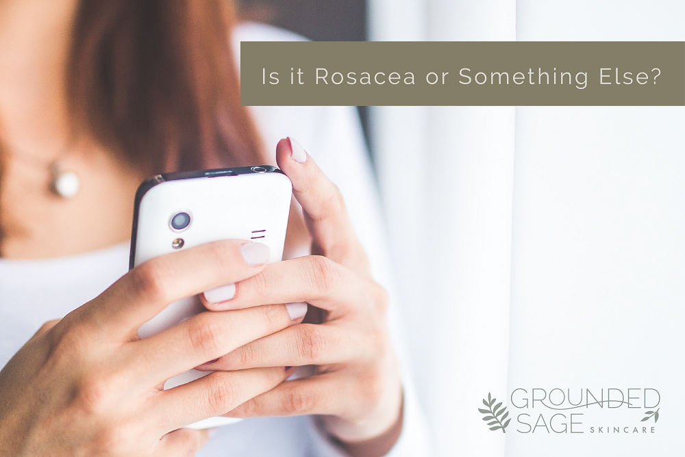 is it rosacea or something else / skin redness/ acne bumps / rosacea skincare / rosacea tips / sensitive skin / green beauty