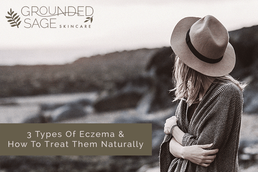 3 types of eczema / green beauty / holistic beauty / skincare for eczema