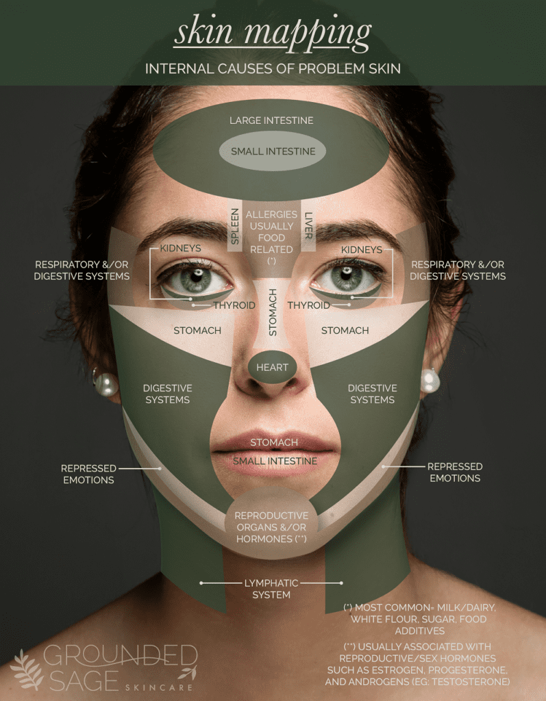 face mapping infographic / skin mapping / acne explained / acne breakouts / skincare / green beauty / holistic beauty 
