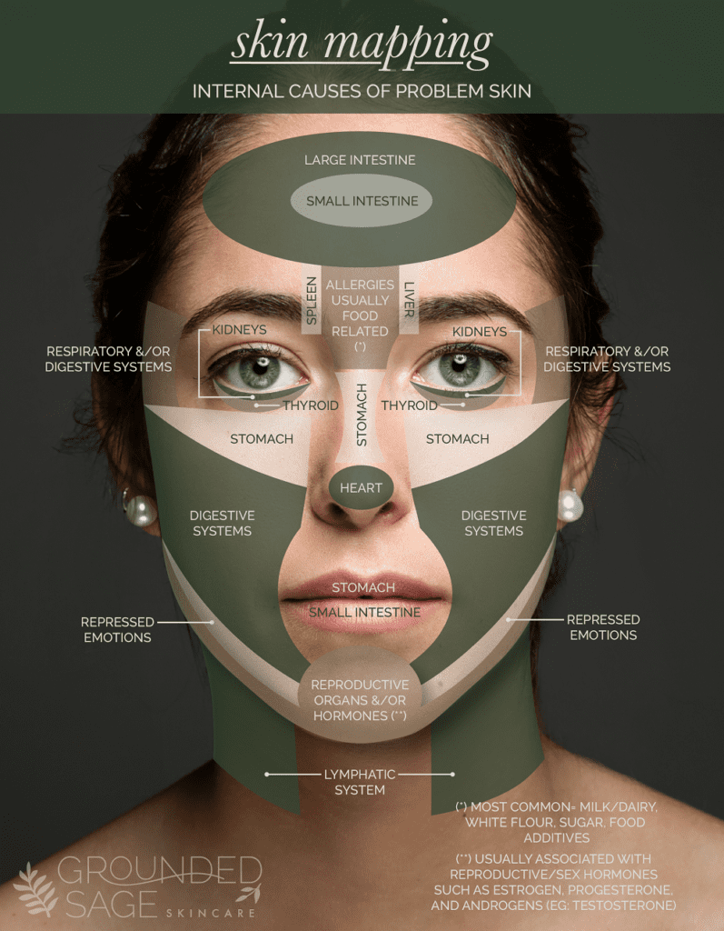 Pimple Causes Chart