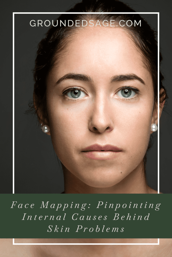 acne face map / skin mapping / acne explained / internal causes of acne / holistic beauty / green beauty