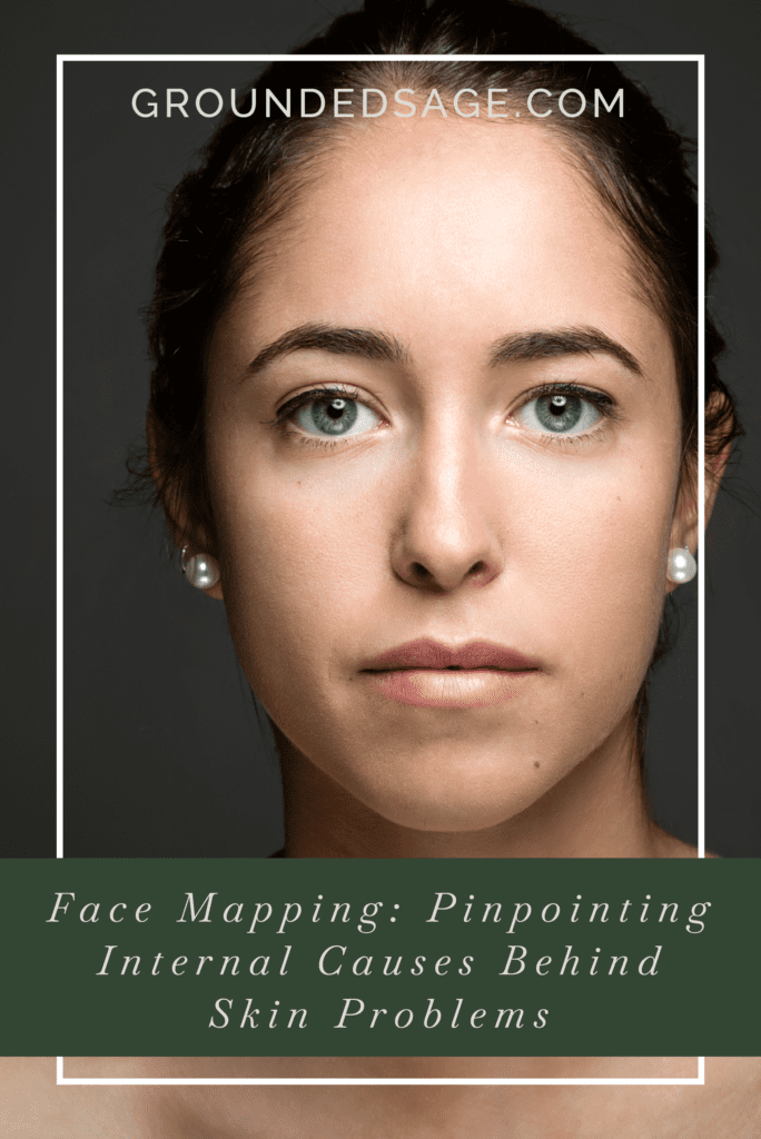 Acne Face Map: Skin Mapping Chart - Pinpoint Internal Causes of