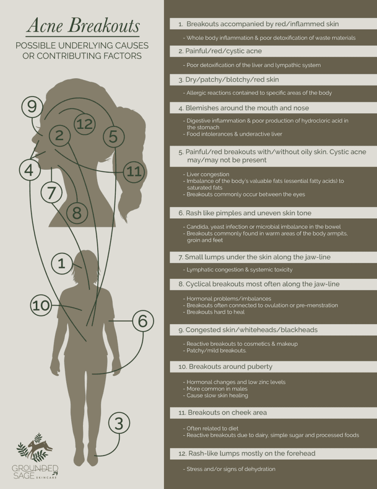 Underlying Causes of Acne & Breakouts (Infographic) - Grounded Sage