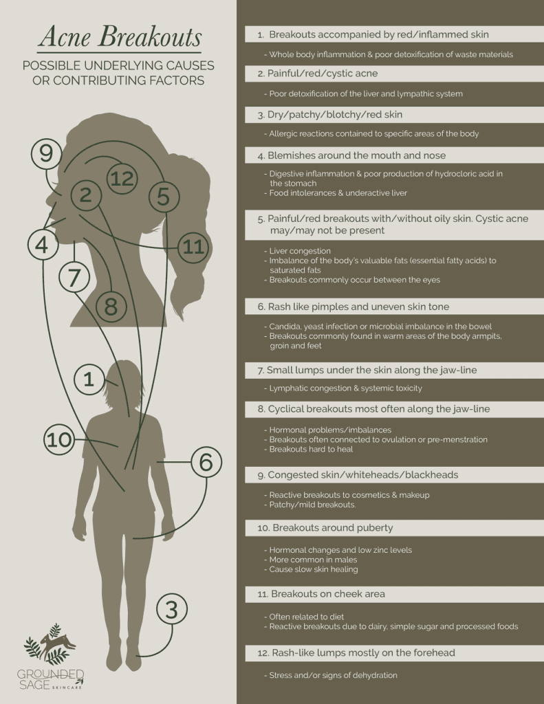 underlying causes of acne/ acne care/ acne skincare/ holistic beauty / green beauty/ internal healing for acne/ infographic