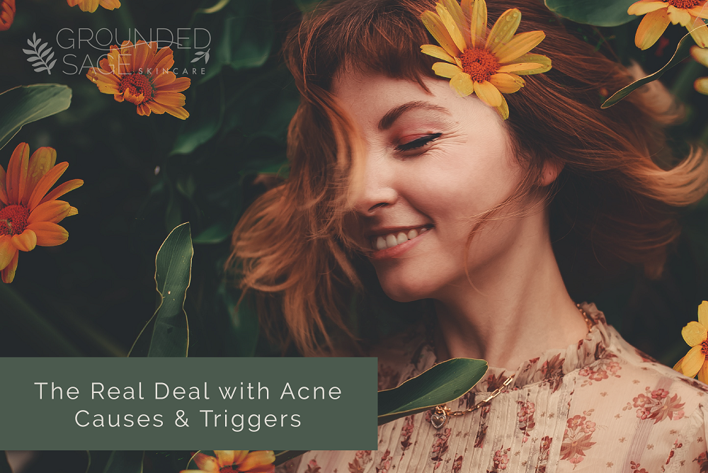 acne triggers and causes / internal healing for acne / holistic beauty / acne care / green beauty