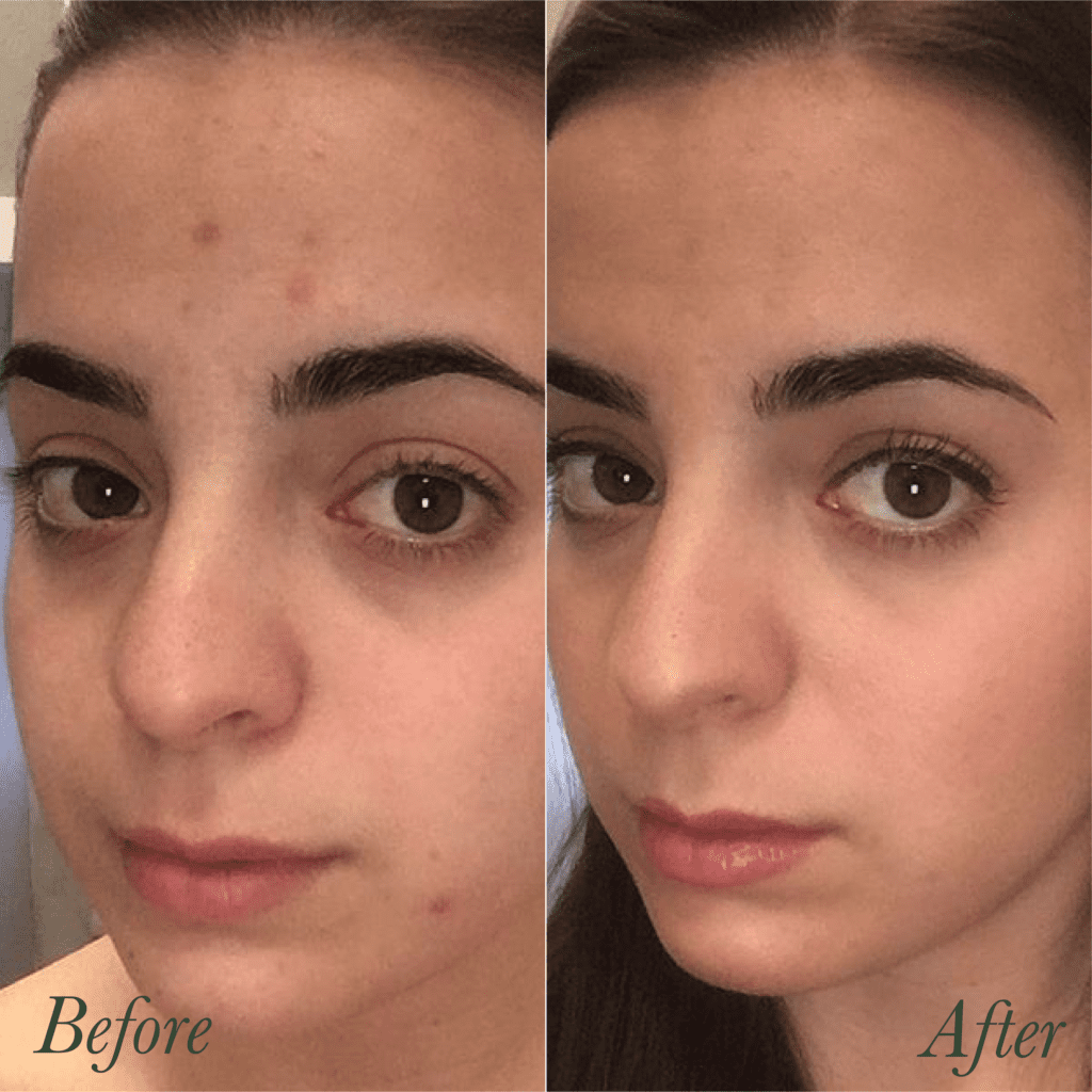 Mineral makeup foundation / green beauty / before and after