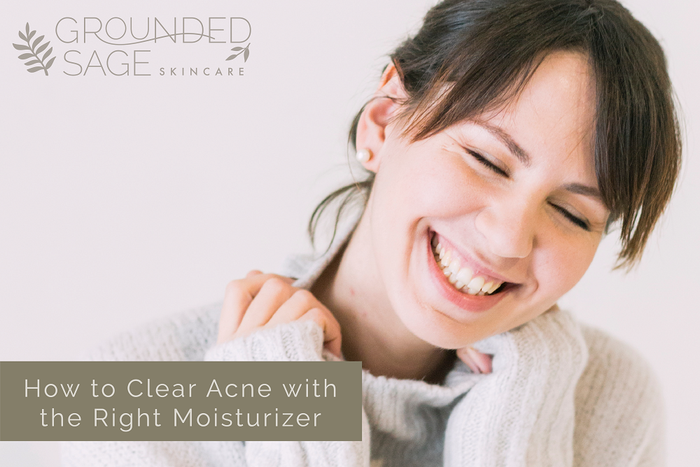 how to clear acne with the right moisturizer - acne care / acne solutions / facial moisturizer / oils for acne / green beauty 