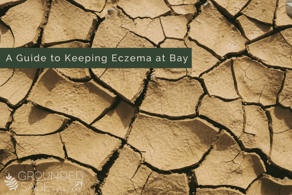 A guide to keeping eczema at bay / eczema tips / green beauty / holistic skincare / dry skin / itchy skin 