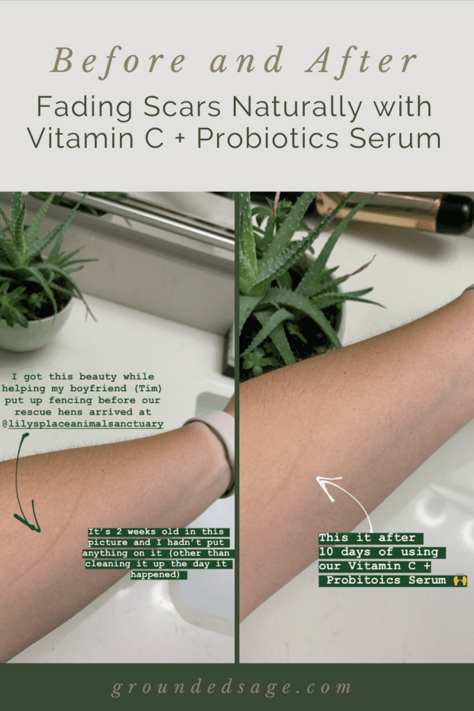 fade acne scars naturally with vitamin c serum with probiotics