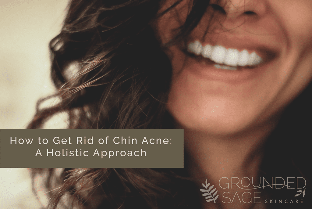 How to get rid of chin acne - causes, remedies and treatment for hormonal acne including products for a simple skincare routine