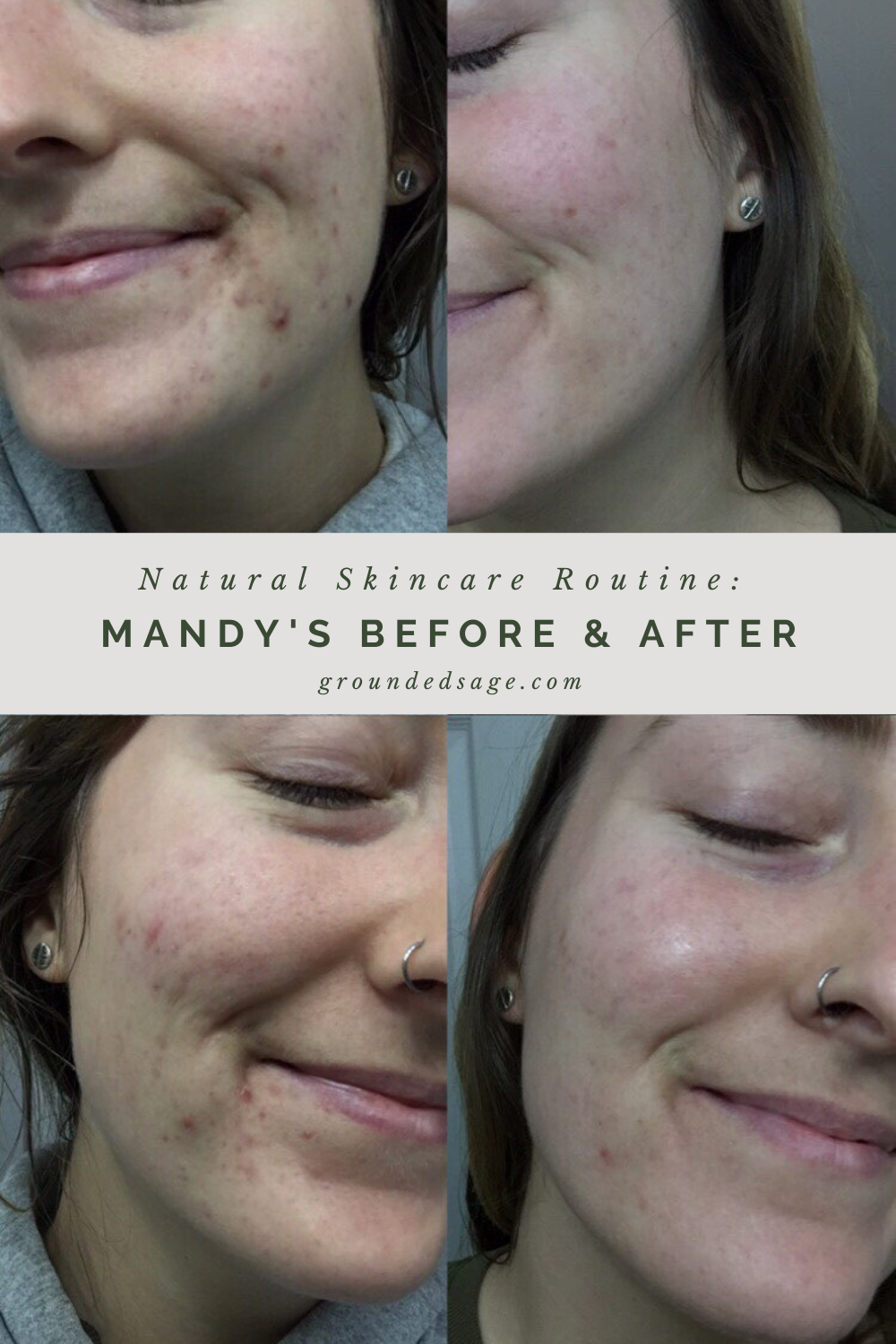 Mandy's Before & After Story - Grounded Sage