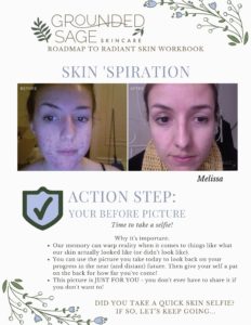 Acne before and after pictures clear skin remedy - natural remedies