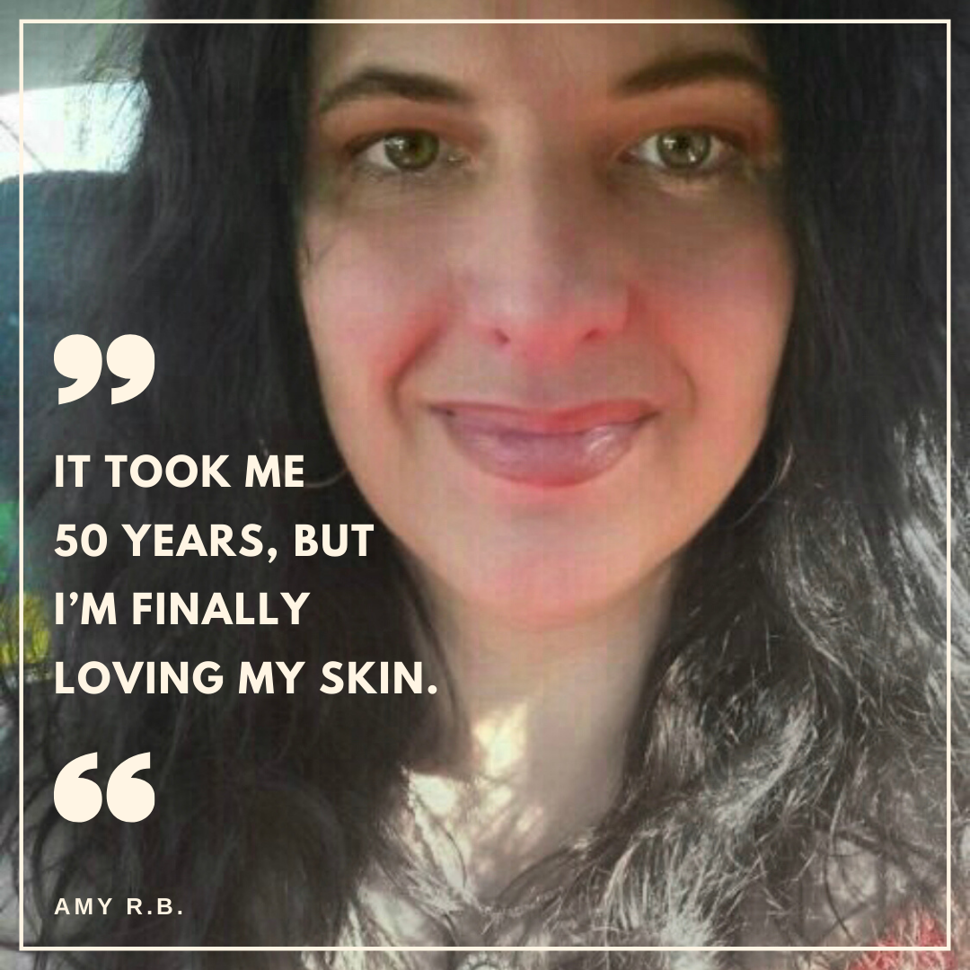 It took me 50 years, but I’m finally loving my skin. Lessons learned about how to take care of my skin that are working for me when drugstore and department store products failed.